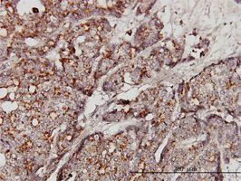 Immunohistochemistry (Formalin/PFA-fixed paraffin-embedded sections) - Anti-GBA antibody [2E2] (AB55080)