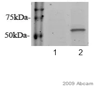 Western blot - Anti-GBA antibody [2E2] (AB55080)