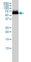 Western blot - Anti-GBA antibody [2E2] (AB55080)