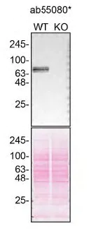 Western blot - Anti-GBA antibody [2E2] (AB55080)