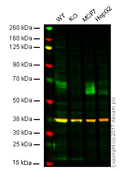 Western blot - Anti-GBA antibody [2E2] (AB55080)