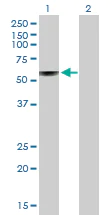 Western blot - Anti-GBA antibody (AB88300)