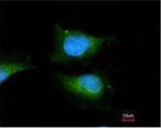 Immunocytochemistry/ Immunofluorescence - Anti-GBA antibody (AB96246)