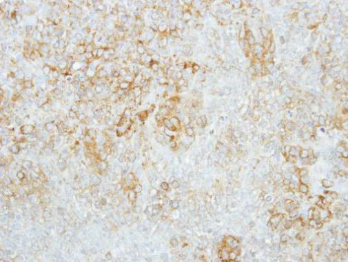 Immunohistochemistry (Formalin/PFA-fixed paraffin-embedded sections) - Anti-GBA antibody (AB96246)
