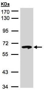 Western blot - Anti-GBA antibody (AB96246), expandable thumbnail