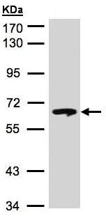Western blot - Anti-GBA antibody (AB96246)