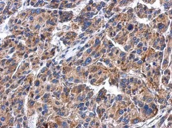 Immunohistochemistry (Formalin/PFA-fixed paraffin-embedded sections) - Anti-GBA antibody (AB96256)