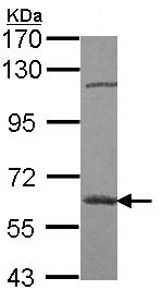 Western blot - Anti-GBA antibody (AB96256), expandable thumbnail
