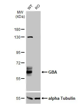 Western blot - Anti-GBA antibody (AB96256)