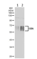 Western blot - Anti-GBA antibody (AB96256)
