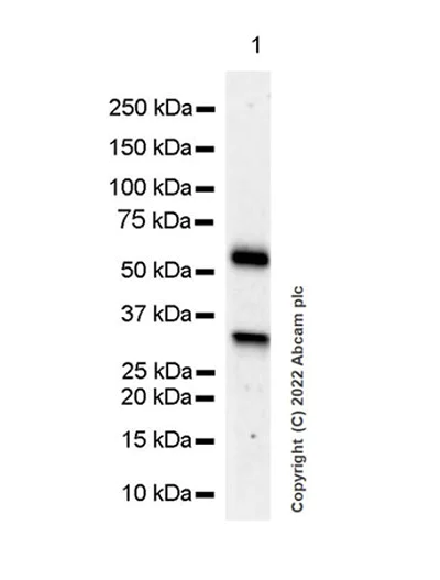 Western blot - Anti-GBA antibody [EPR24106-87] (AB303508)