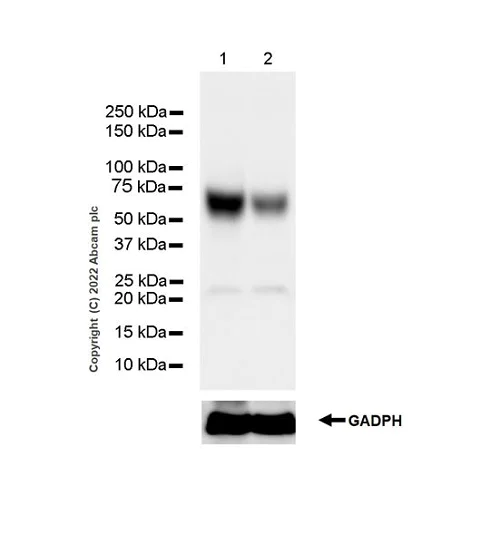 Western blot - Anti-GBA antibody [EPR24106-87] - BSA and Azide free (AB303509)