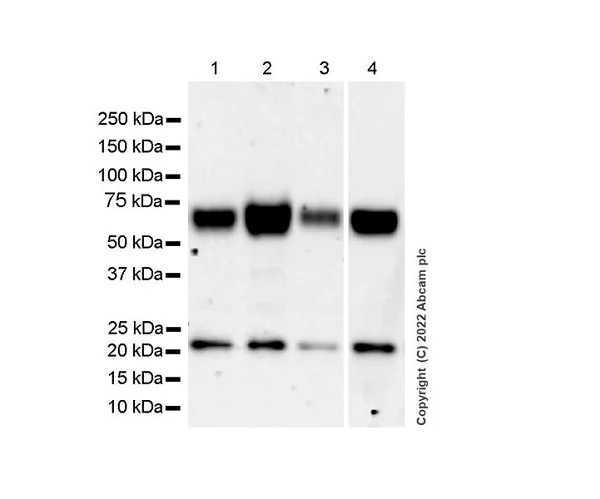 Western blot - Anti-GBA antibody [EPR24106-87] - BSA and Azide free (AB303509)