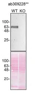 Western blot - Anti-GBA antibody [EPR26755-29] - BSA and Azide free (Capture) (AB309228)