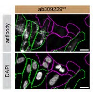 Immunocytochemistry/ Immunofluorescence - Anti-GBA antibody [EPR26755-42] - BSA and Azide free (Detector) (AB309229)