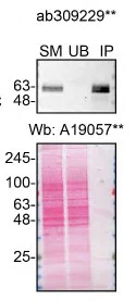Immunoprecipitation - Anti-GBA antibody [EPR26755-42] - BSA and Azide free (Detector) (AB309229)