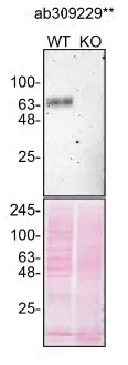Western blot - Anti-GBA antibody [EPR26755-42] - BSA and Azide free (Detector) (AB309229)