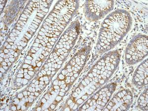 Immunohistochemistry (Formalin/PFA-fixed paraffin-embedded sections) - Anti-GBA antibody [EPR5142] (ab125065), expandable thumbnail
