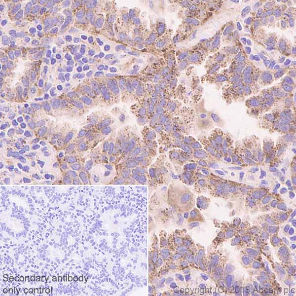 Immunohistochemistry (Formalin/PFA-fixed paraffin-embedded sections) - Anti-GBA antibody [EPR5142] (AB125065), expandable thumbnail