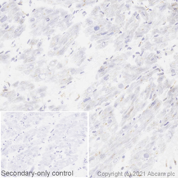 Immunohistochemistry (Frozen sections) - Anti-GBA antibody [EPR5142] (AB125065), expandable thumbnail
