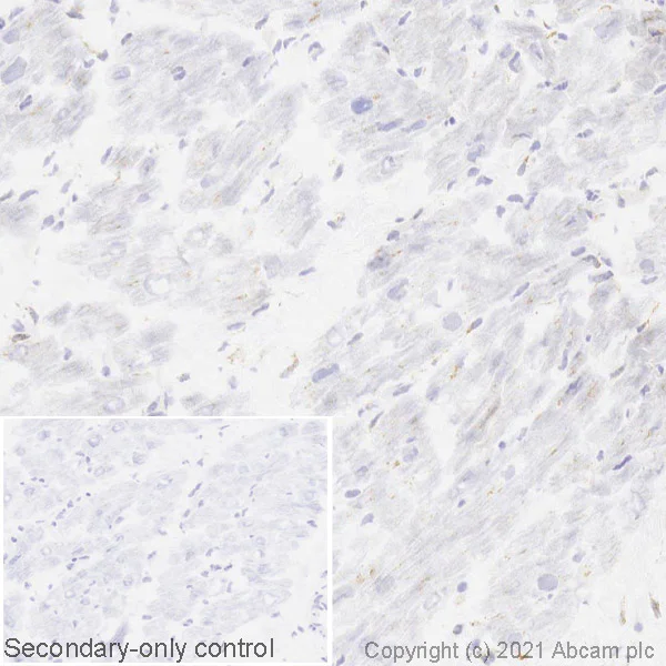 Immunohistochemistry (Frozen sections) - Anti-GBA antibody [EPR5142] (AB125065)