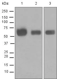 Western blot - Anti-GBA antibody [EPR5142] (AB125065)