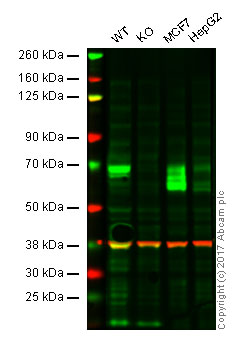 Western blot - Anti-GBA antibody [EPR5142] (ab125065), expandable thumbnail