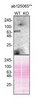 Western blot - Anti-GBA antibody [EPR5142] (ab125065), expandable thumbnail