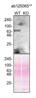 Western blot - Anti-GBA antibody [EPR5142] (AB125065)
