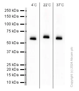 Western blot - Anti-GBA antibody [EPR5142] (AB125065)
