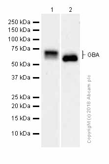 Western blot - Anti-GBA antibody [EPR5142] (ab125065), expandable thumbnail
