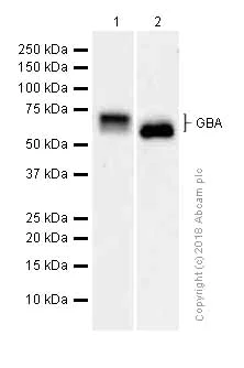 Western blot - Anti-GBA antibody [EPR5142] (AB125065)