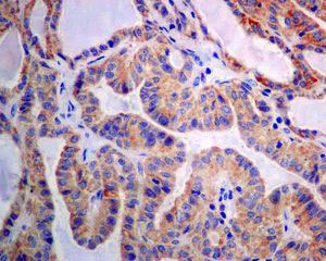 Immunohistochemistry (Formalin/PFA-fixed paraffin-embedded sections) - Anti-GBA antibody [EPR5143(3)] (ab128879), expandable thumbnail