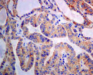 Immunohistochemistry (Formalin/PFA-fixed paraffin-embedded sections) - Anti-GBA antibody [EPR5143(3)] (AB128879)