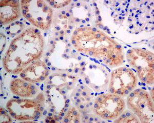 Immunohistochemistry (Formalin/PFA-fixed paraffin-embedded sections) - Anti-GBA antibody [EPR5143(3)] (ab128879), expandable thumbnail