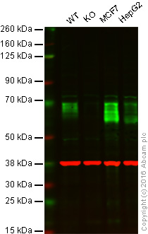 Western blot - Anti-GBA antibody [EPR5143(3)] (AB128879), expandable thumbnail