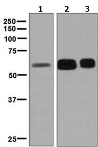 Western blot - Anti-GBA antibody [EPR5143(3)] (ab128879), expandable thumbnail