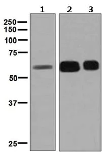 Western blot - Anti-GBA antibody [EPR5143(3)] (AB128879)