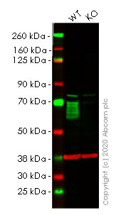 Western blot - Anti-GBA antibody [EPR5143(3)] (AB128879), expandable thumbnail