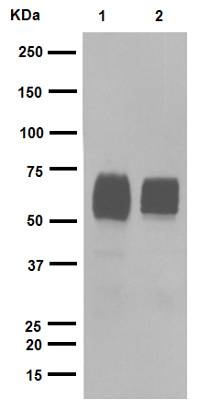 Western blot - Anti-GBA antibody [EPR5143(3)] (AB128879), expandable thumbnail
