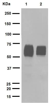 Western blot - Anti-GBA antibody [EPR5143(3)] (AB128879)