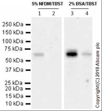 Western blot - Anti-GBA antibody [EPR5143(3)] (AB128879), expandable thumbnail