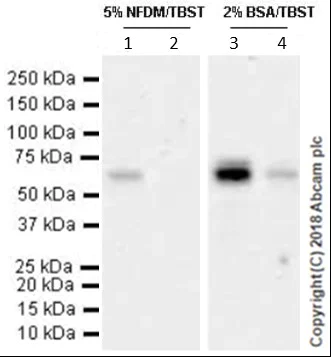 Western blot - Anti-GBA antibody [EPR5143(3)] (AB128879)