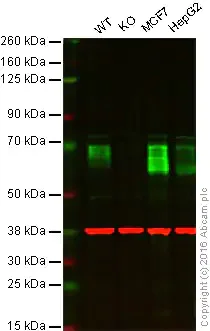 Western blot - Anti-GBA antibody [EPR5143(3)] - BSA and Azide free (AB215260)