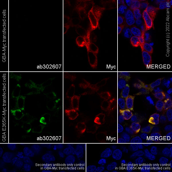Immunocytochemistry/ Immunofluorescence - Anti-GBA (mutated E326K) antibody [EPR24900-273] (BSA and Azide free) (AB302608), expandable thumbnail