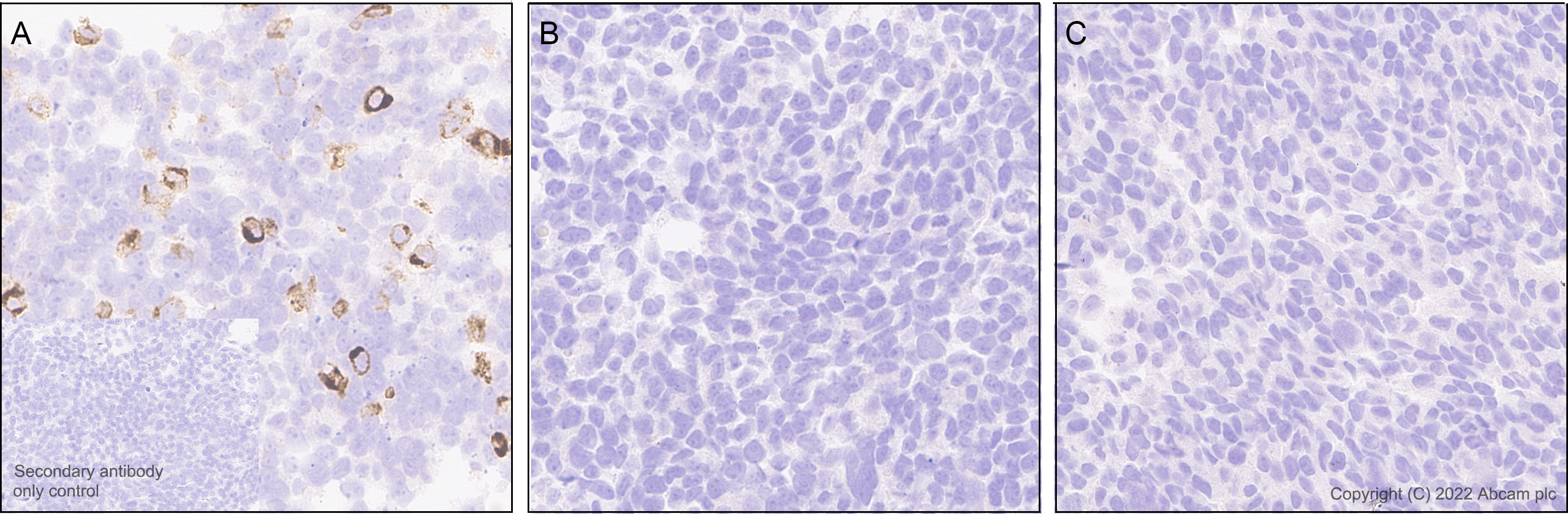 Immunohistochemistry (Formalin/PFA-fixed paraffin-embedded sections) - Anti-GBA (mutated E326K) antibody [EPR24900-273] (BSA and Azide free) (ab302608), expandable thumbnail