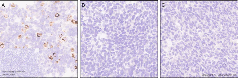 Immunohistochemistry (Formalin/PFA-fixed paraffin-embedded sections) - Anti-GBA (mutated E326K) antibody [EPR24900-273] (BSA and Azide free) (AB302608)