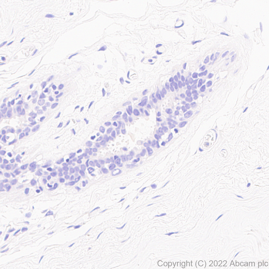 Immunohistochemistry (Formalin/PFA-fixed paraffin-embedded sections) - Anti-GBA (mutated E326K) antibody [EPR24900-273] (BSA and Azide free) (AB302608), expandable thumbnail