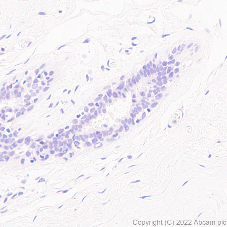 Immunohistochemistry (Formalin/PFA-fixed paraffin-embedded sections) - Anti-GBA (mutated E326K) antibody [EPR24900-273] (BSA and Azide free) (AB302608)