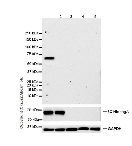 Western blot - Anti-GBA (mutated E326K) antibody [EPR24900-273] (BSA and Azide free) (AB302608)